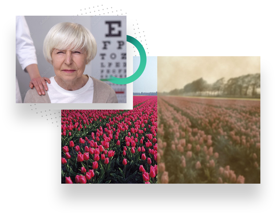 Symptome Ursachen Kopie - Staar (Cataract) - Augenärzte Gerl & Kollegen