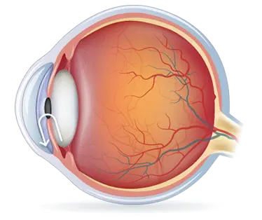 Gesundes Auge 1 - Glaucoom - Augenärzte Gerl & Kollegen