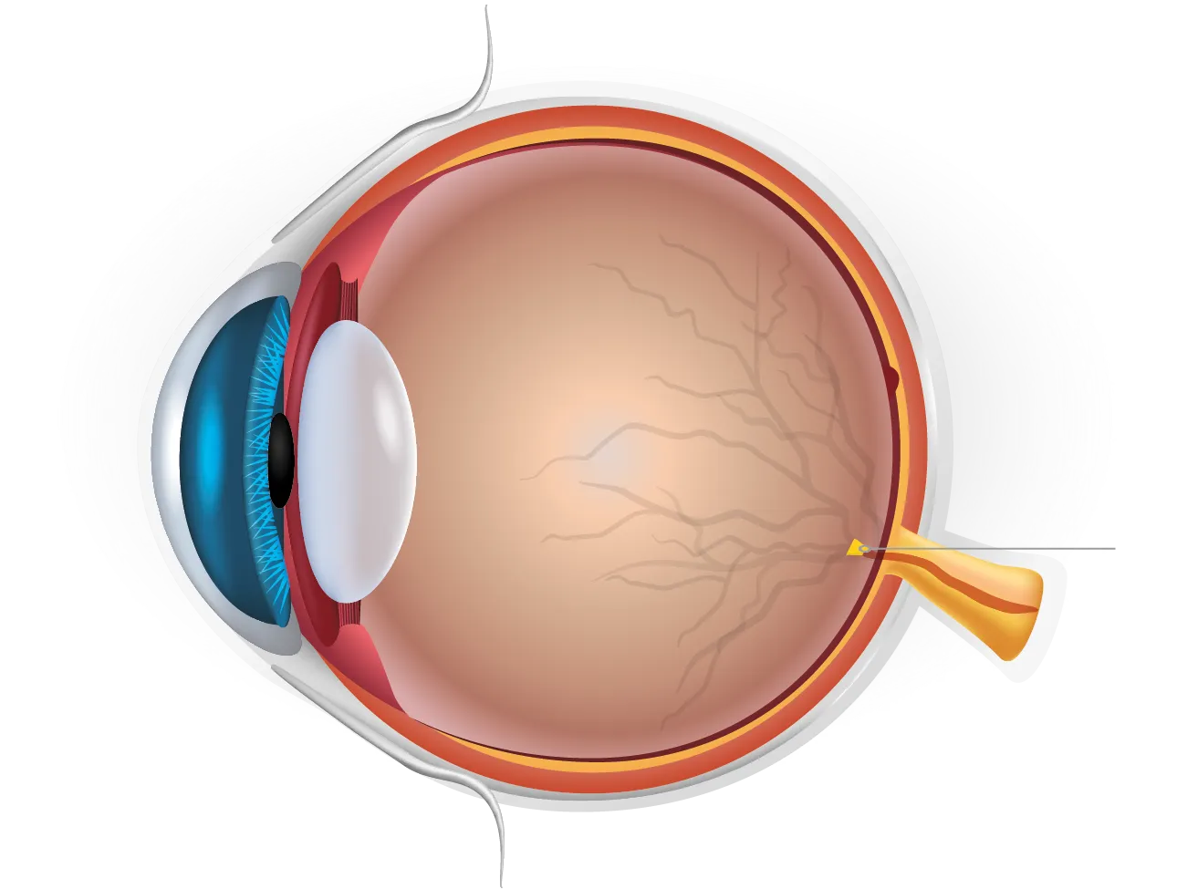 Arterielle Verschlüsse