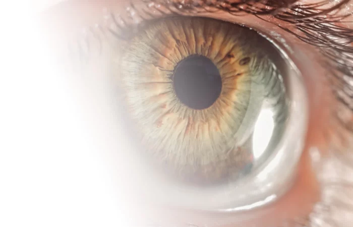 Fehlstellungen der Augenlider