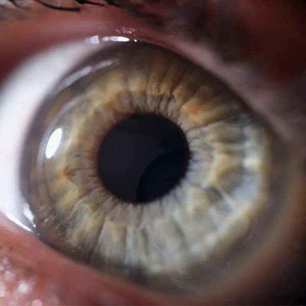 Normale transparente Hornhaut