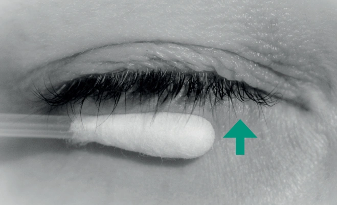 Reinigung I - Lidrandpflege