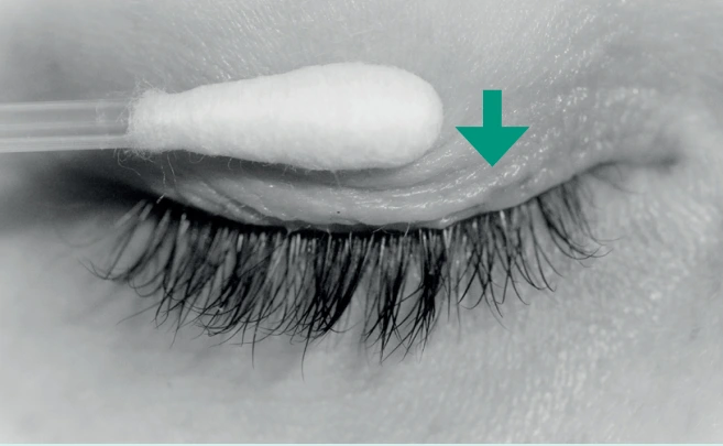 Lidmassage - Lidrandpflege