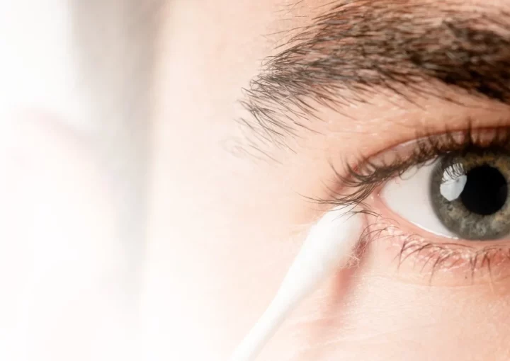 12Lidrandpflege - Sicca syndroom - Therapie en behandeling - Augenärzte Gerl & Kollegen